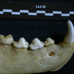 Dentition inférieure