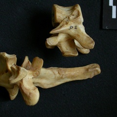 Vértebras torácicas