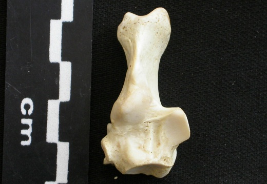 Calcaneus